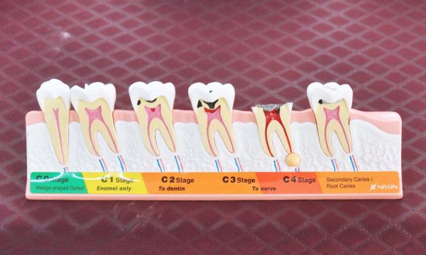 world oral health day malaysian dental association teeth