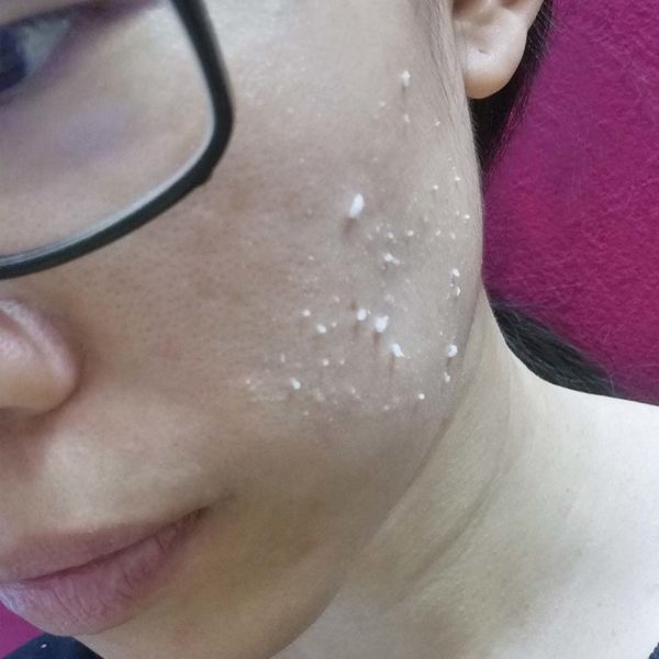 glamogenic australian skincare brand brassica peeling gel clumps