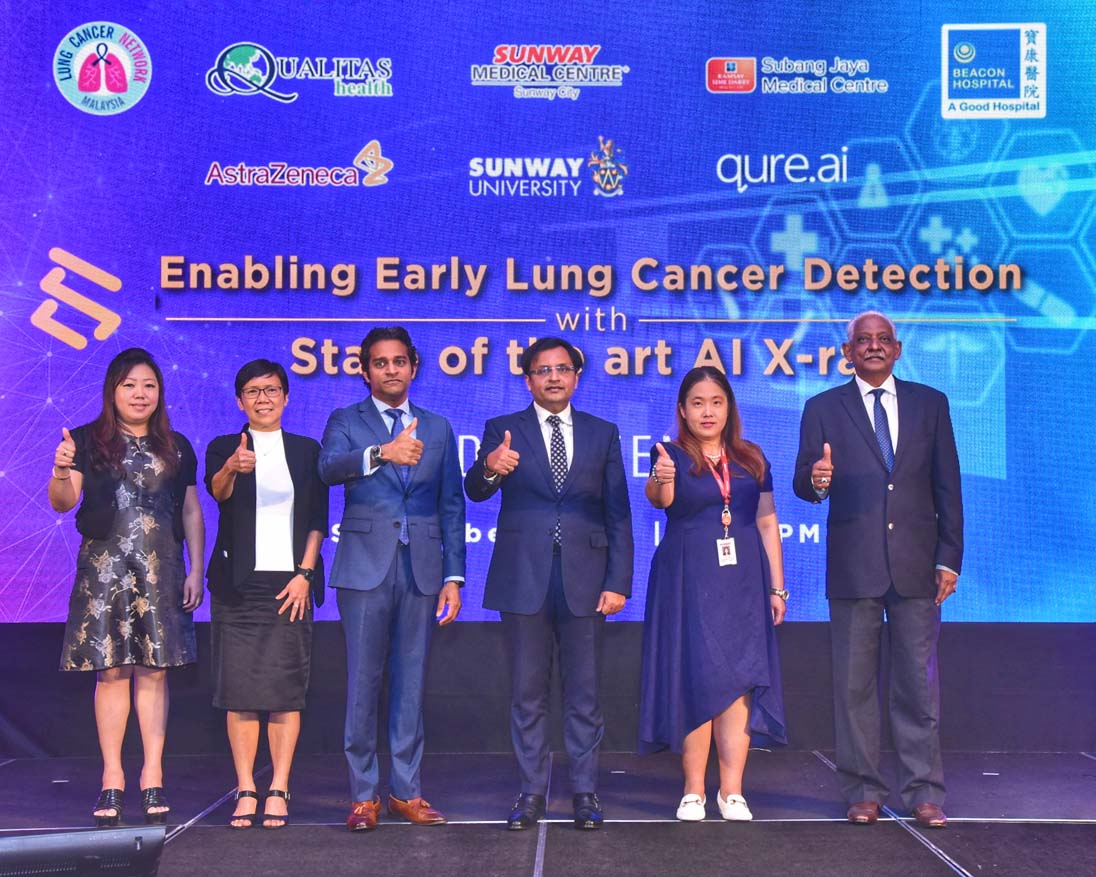 Lung Cancer Diagnosis with Artificial Intelligence Technology