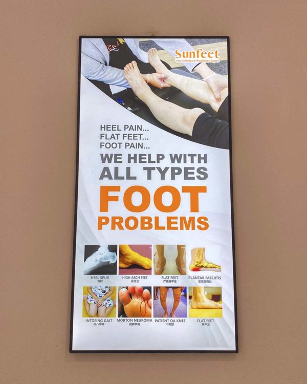 sunfeet orthotics expert cheras south foot problem solutions